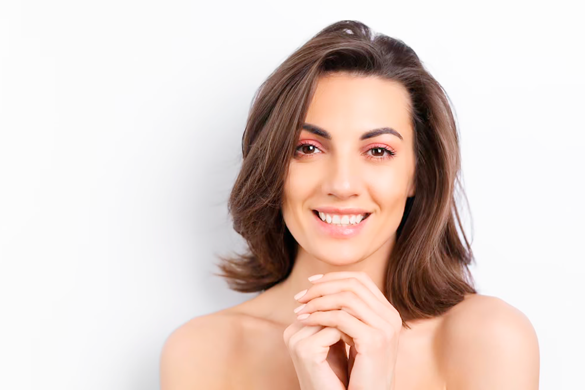 Melasma